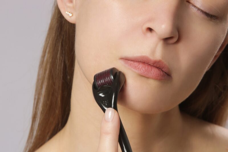 devojka koristi roler za mezoterapiju