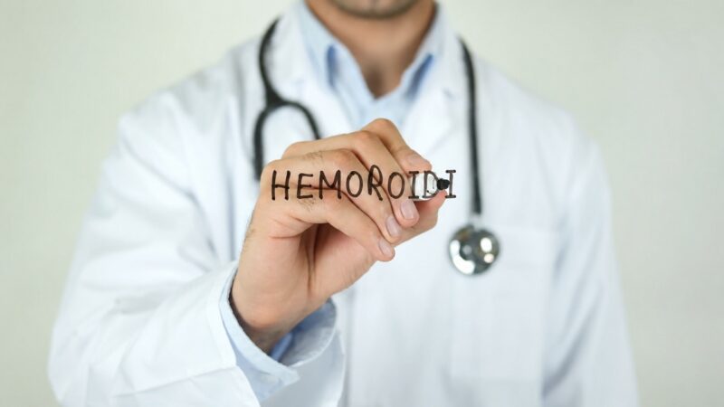 Spoljašnji hemoroidi
